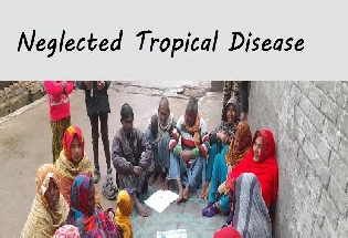 Neglected Tropical Disease Day : 30 जनवरी को एनटीडी दिवस पर विशेष