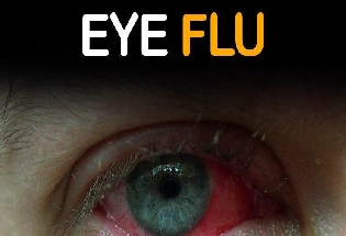 Eye Flu हो जाए तो आजमाएं 5 घरेलू नुस्खे, तुरंत ही मिलेगा आराम